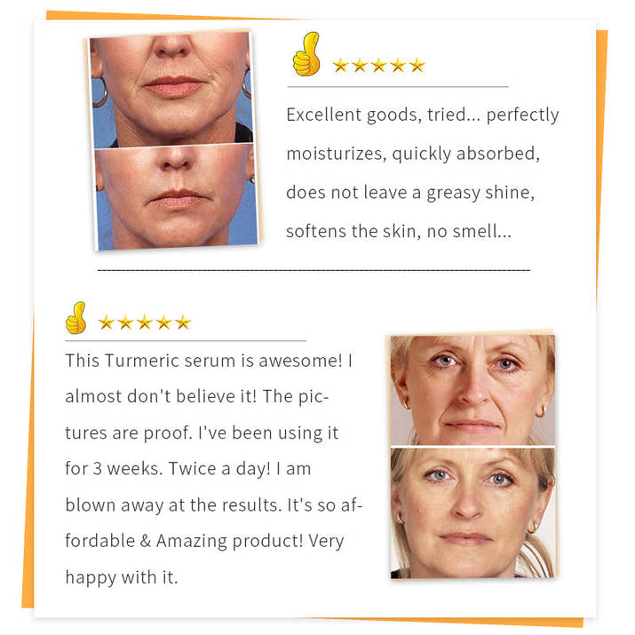 Fade Fine Lines And Wrinkles Skin Moisturizing