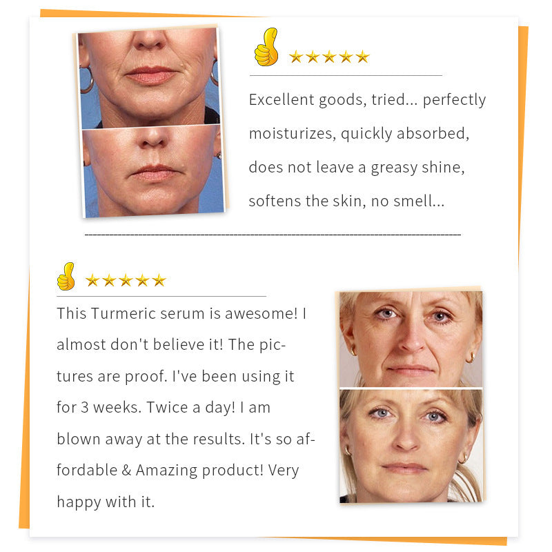 Fade Fine Lines And Wrinkles Skin Moisturizing